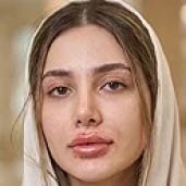بعد از تزریق فیلر لب